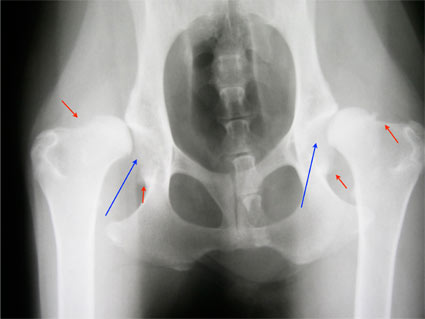 Hip dysplasia