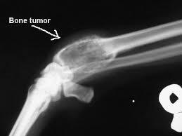 Osteosarcoma in dogs