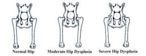 ízületi dysplasia kezelés